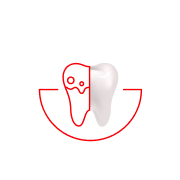 Fogkőképződés csökkentése