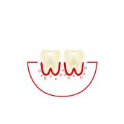 Heti 3 alkalomnál kevesebbszer