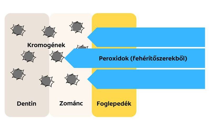 Mire kell ügyelnünk a fogfehérítő termék kiválasztásakor? 2