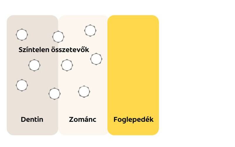 Mire kell ügyelnünk a fogfehérítő termék kiválasztásakor? 3